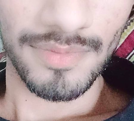 pic loading ...
