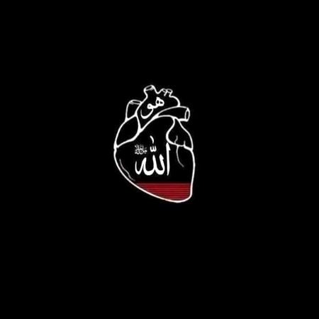 pic loading ...