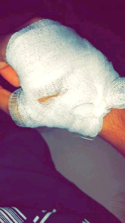 Bike say gir gya🥺😔