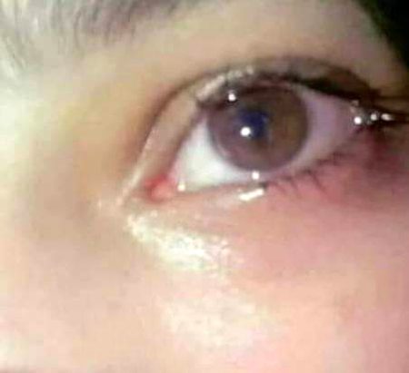 آپ روتے ہیں  یاد کر کے مجھے? 
چھوریے ناں مزاق کی باتیں
ذہنی مریضہ