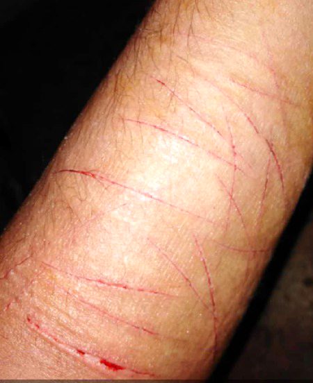 ہماری موت بھی کیا موت ہوگی
تم پہ مرتے ہوئے ,, مر جائیں گے