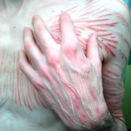 No scars .. you're beautiful