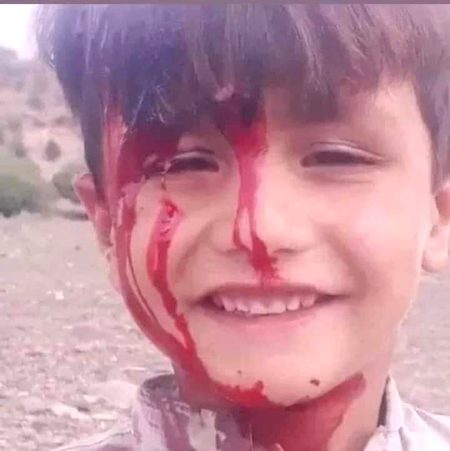 بغاوت جا زخم!
ايڏا حسين به ھوندا آھن ڇا؟
جو دڙڪو ملڻ تي روئڻ وارا ٻار
گولي لڳڻ تي به مسڪرائي رھيا آھن.
ھي چاغي جو بلوچ ٻار آھي، جيڪو گولي ۾ گھايل ٿيڻ کانپوءِ به حمله آورن کي فاتحانه مسڪراھٽ جا گولا ھڻي رھيو آھي.✌️