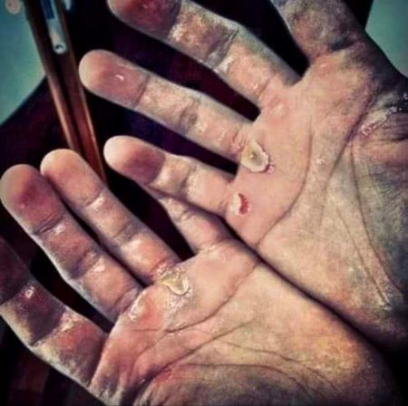 زاہد کو فخر ہے اگر ، سجدے کے نشاں پر ،
ہم مزدورو کے چھالے بھی بڑے غور طلب ہیں۔۔!! 😢