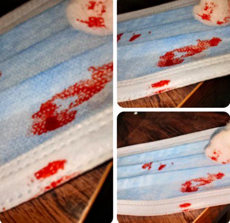 Akhy Migraine Hy Ye hy wo Hy Dekho Isko Kty Sar drd Zra Sa Drd Utha ---- Or  Blood Shoro Ogya nose sy.j1