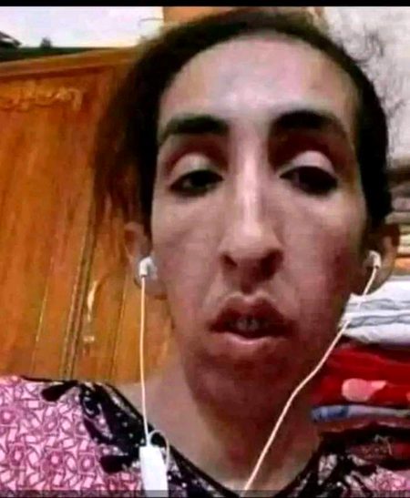 ہزاروں قسمیں اور لاکھوں منتوں کے بعد جب Sadaf Ali ویڈیو کال پر راضی ہوئی اس کے بعد اب تک میری طبیعت ناساز ہے
دعا کی اپیل 🙏🙂🙂