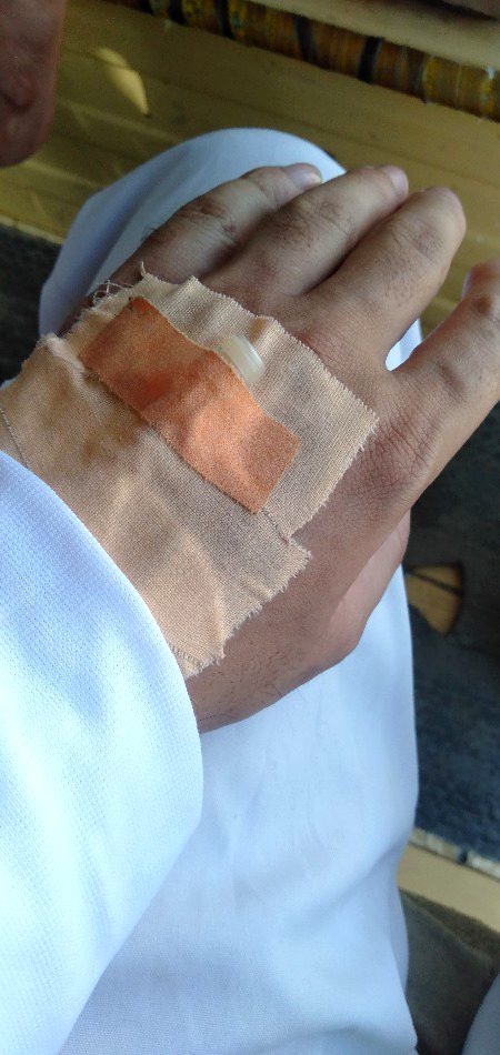 Aik din rehta aur halat Dekho ab ..