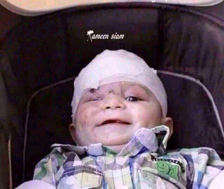 اس ننے فرشتے کی یہ مسکراہٹ امت مسلمہ کے منہ پہ طمانچہ ہے۔
Free palestine🙏🇸🇩🇸🇩🇸🇩