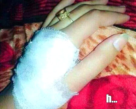 chot lgi h ussa mhsoos mujh kio hua h h....💔😭💔😭😢 😢