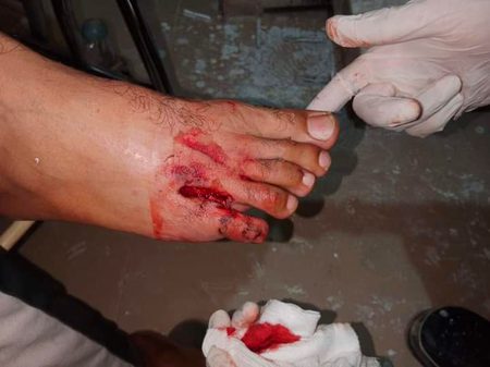 چوٹ کھا کر بھی شُکر ادا کریں گے..🙏
ہم کبھی مالک سے شکوہ نہیں کرتے..🚩
سرکار🎀