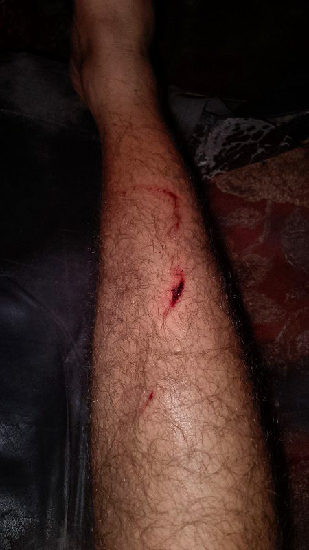 Accident 🥺🥺🥺🥺