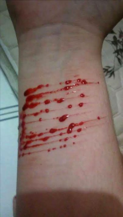 ہاں آج درد کی وہ شدت ہے 
جس میں کہتے ہیں موت بہتر ہے