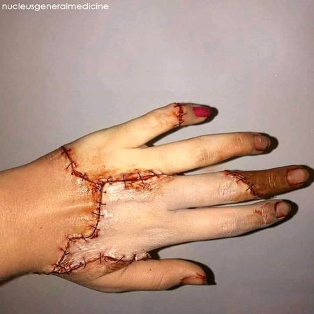 میں نے چاہا تھا زخم بھر جائیں💔
 ذخم ہی ذخم بھر گئے مجھ میں🥀