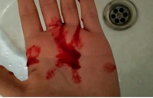 💔😭😢 💔😭😢