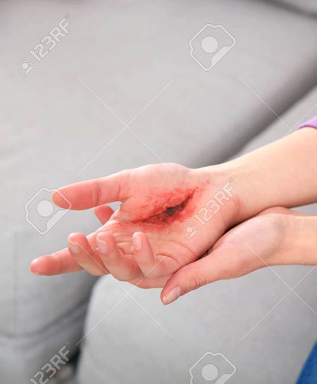 پھر سوچا کیوں نہ لائف لائن کو ہی مٹا دیا🤔🙂 جائے 
Alóñé Gírl 💔