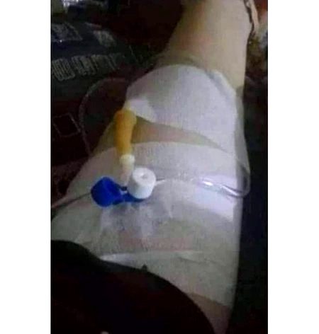 مجھے ملنے والا ہر وہ شخص مجھ سے متاثر ہو کے مجھے کچھ عرصے بعد روگ دے کے چھوڑ...
دیتا ہے۔"💔🙂