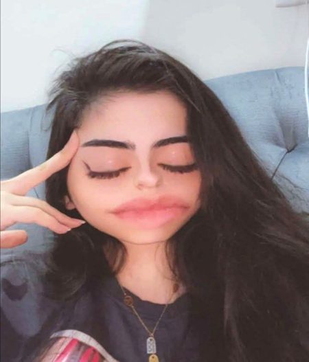 انگلیاں پھیر میرے بالوں میں
کہ جوئیں آرام نہیں کر رہی🥹🚶🏼♀️