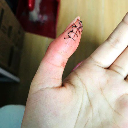 Stitches xD