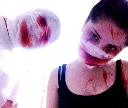 bloody bandages