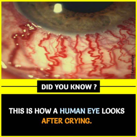 View of the eye after weeping