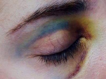 اُداس 💔 
خد و خال کی دھجیاں اڑ جاتی ھیں
ہائے یہ ہجر ھے، کوئی مذاق تھوڑا ھے
💔