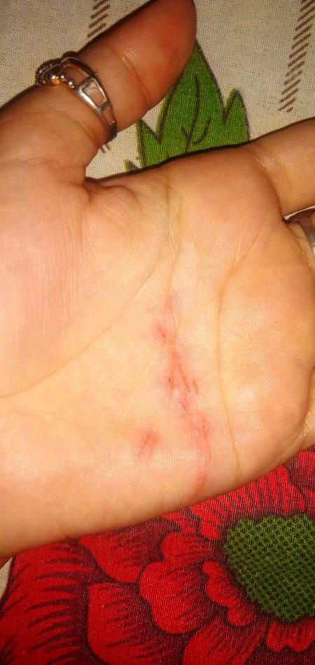 میرے اپنوں کو میری تکلیف میں خوشی ملتی💔 ہے ۔۔۔
چلو اب انھیں بھی خوش کیا جائے ۔۔🥀