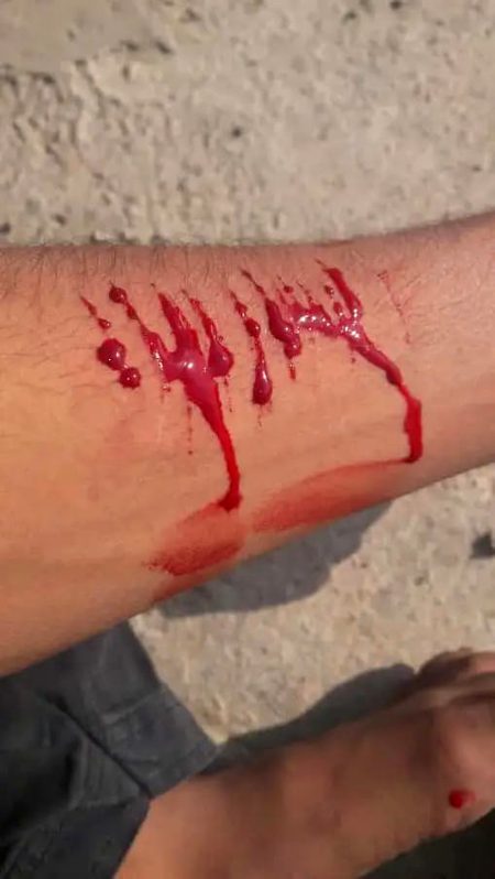 _تم میرے صبر کا اندازہ نہیں لگا سکتے اسے ہنس کر چھوڑ دیا جسے رو کر مانگا تھا-😖💔_