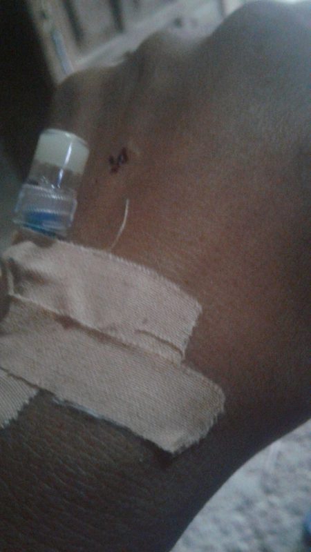 All frinds dua karin please 😕😕maleriya ki wjha bhot bura hall hin 😢