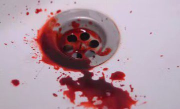 today condition💔😭😢after eating 10 panadol