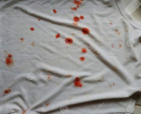 حادثہ, ہارٹ اٹیک ,تو ٹھیک ....!!!💔
ہاۓ وہ دماغ کی رگوں کا پھٹ جانا۔۔۔۔۔!!!!💔