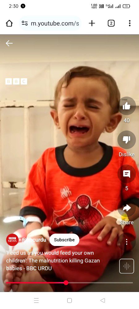 Around One hundred thousand children in Gaza facing severe malnutrition and dozens dying of Starvation, Who's Responsible?