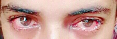 Mere aankhin 3 din me nhi ae adr na mub na TV na koi bhi roshni aankho py nhi any de q ky وائرس aya hin ankho ka