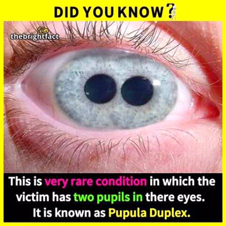 Interesting Posts image