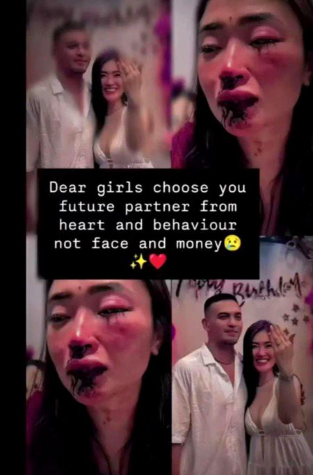 🥺🫠🫠🫠🥺🫠🫠🫠🥺