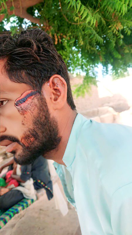 KoCh ApNu Ki Dua KamYaB HoGaiii 💔💔😥😥💯