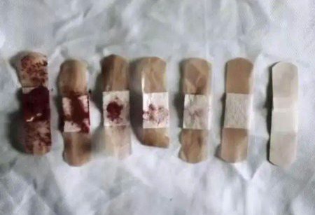 Bloody bandages