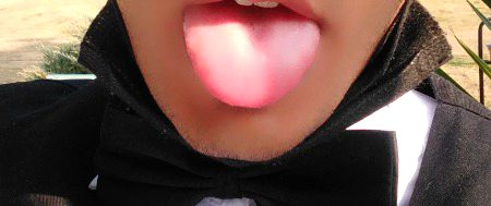 My tongue