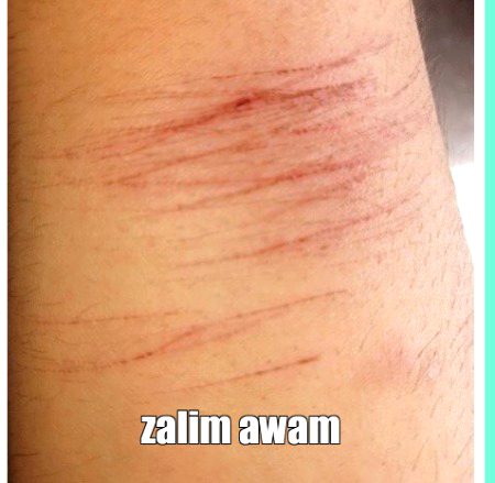 BHT GLT H KHUD KO CHOTT DENA LIFE ADVICE