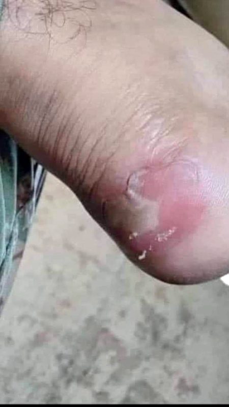 بڑے بڑے بوٹوں میں پاوں کی حالت...🙂
لیکن خیر چھوڑو فوج تو غدار ہے نا...💔
#PAK__ARMY 🇵🇰