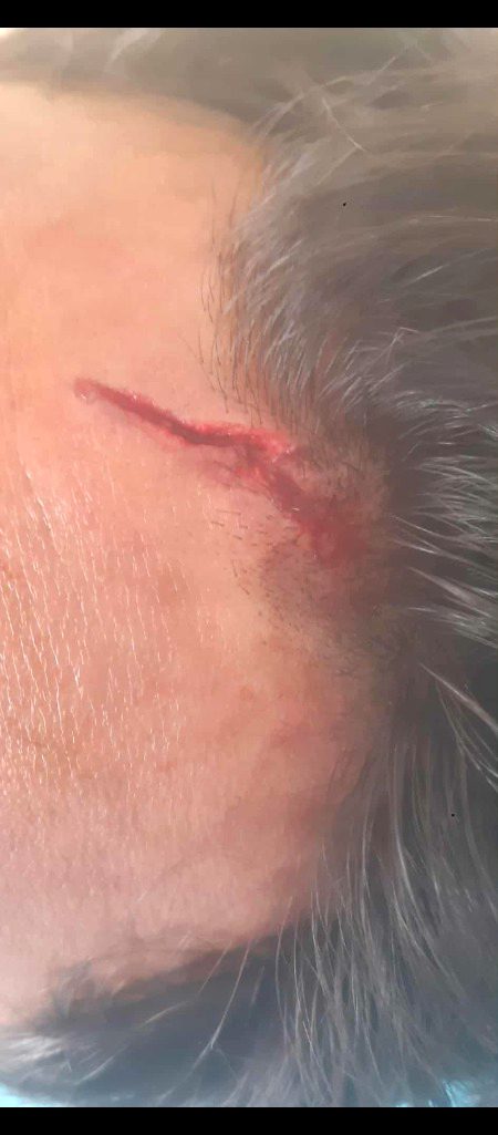 🤕🤕..🤕🤕🤕🤕