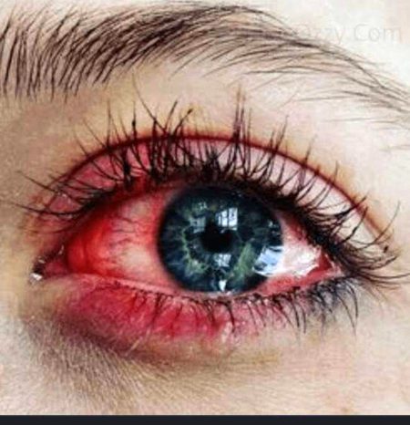 یہ کالے حلقے ہماری اپنی خرید ہیں🤧
یہ سرخ آنکھیں ہمیں نوازی گئی ہیں😭
شاہ