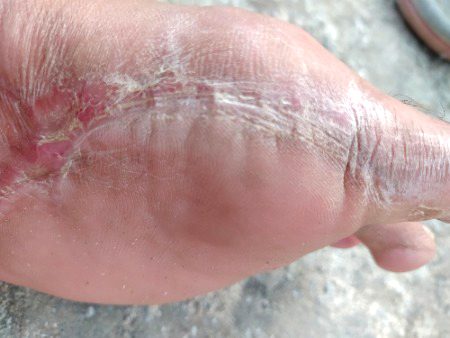 Ya lain or b hai but bata nhi sakta