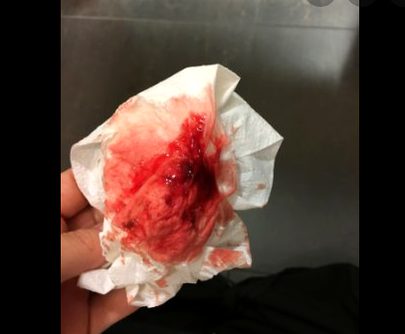 غم بھی دئیے تو یوں کہ نہ واپس لئے کبھی ان کے ہماری ذات پہ احسان ہی رہے panadol zda kha kl mrta tu nh likin hlt buri hujti aj bedrest p dd use hurha